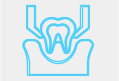 Wisdom Teeth